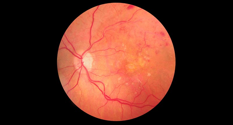 retinal-imaging-adult-pediatric-eyecare-local-eye-doctor-near-you.jpg